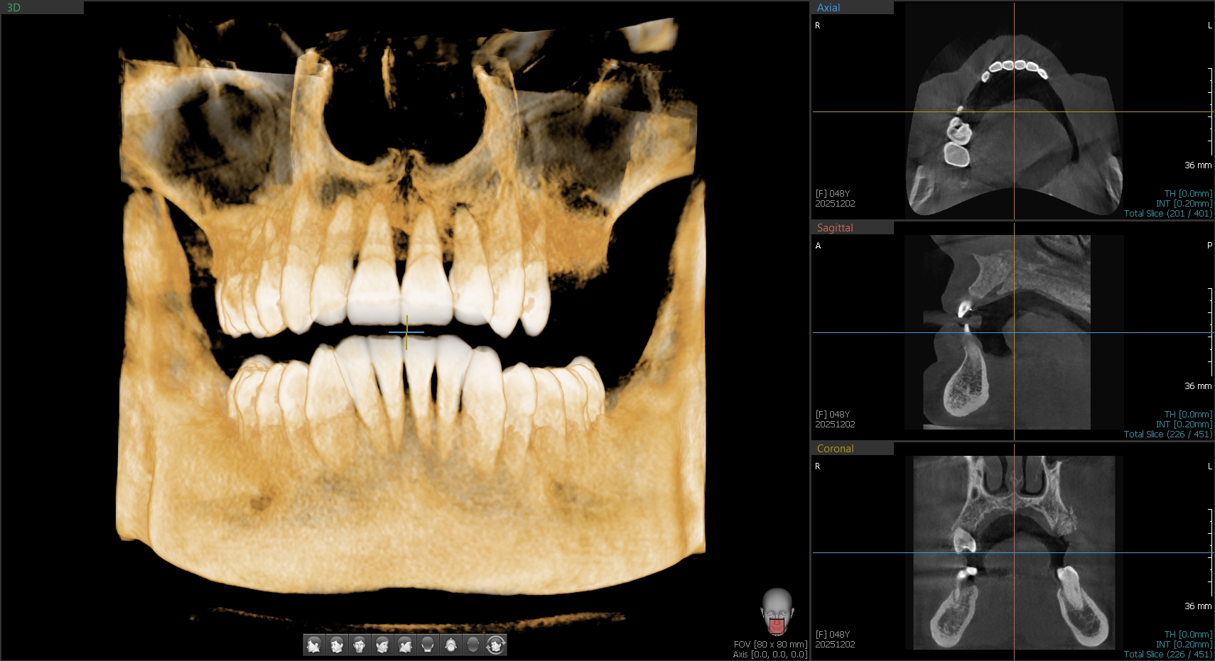 3D CBCT